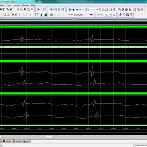 ECG_Processor