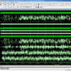 VLSI Design of SVM-Based Seizure Detection System With On-Chip Learning Capability 2 Seizure