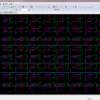 Design of a Scalable Low Power 1 bit Hybrid Full Adder for Fast Computation 1 Hybird_Full_Adder