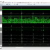 A VLSI-Based Hybrid ECG Compression Scheme for Wearable Sensor Node 1 ECG_Compression