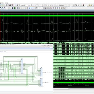 Home 5 Extraction of Fetal ECG
