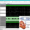 Invasive RLS-Based Fetal ECG Extraction with Optimized Shift-and-Add Multiplier for Area-Efficient FPGA Implementation 1 Invasive RLS-Based Fetal ECG Extraction