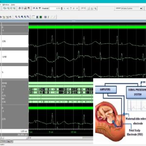 Home 2 Invasive RLS-Based Fetal ECG Extraction