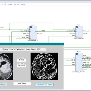 Brain Tumor Detection